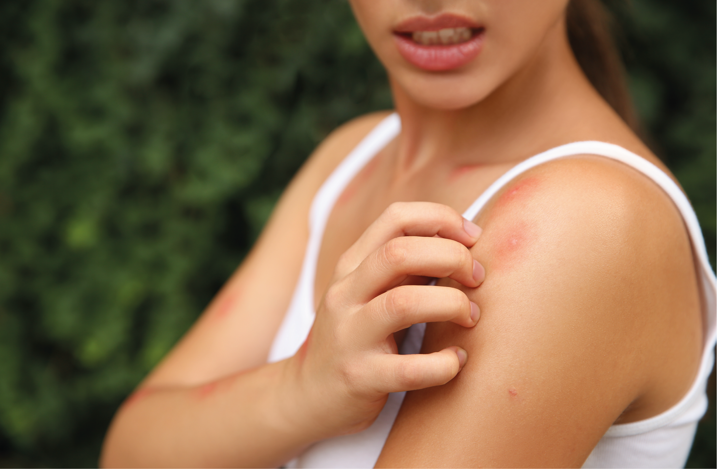 REMEDIOS-AHUYENTAR-MOSQUITOS